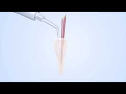 Woodpecker Scaler Tip E3D for UDS & EMS Scalers - 2