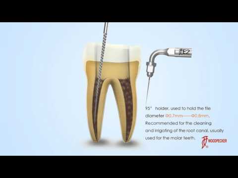 Woodpecker Scaler Tip E2 for UDS & EMS Scalers          - 2