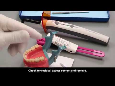 3M ESPE Relyx Luting 2 Refill Packs - 2