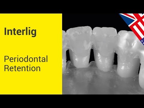 Angelus Interlig Single Patient Strip - 2