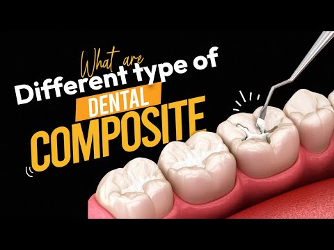 Dentsply Spectrum Composite Kit - 2