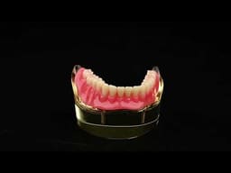 iDENTical Mandibular Overdenture Model with 2 Implants M6002 - 3