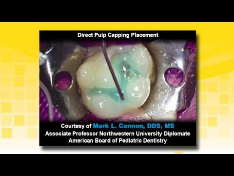 Bisco TheraCal LC Light Cure Resin Cavity Liner Syringe - 2