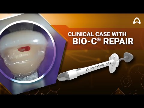 Angelus Bio-C Repair - 2