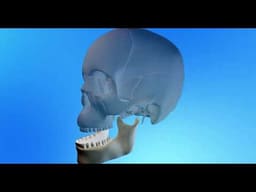 iDENTical Implant Practice Mandible Jaw Model M2025 (1 Piece) - 2