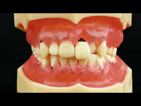 iDENTical Periodontal Model M4003 - 2