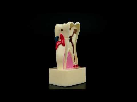 iDENTical 4X Pathologies Of Tooth Model - M4015 - 3