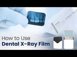 Waldent Dental X-Ray Film E-Speed (Pack Of 100) - 2