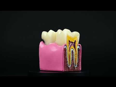 iDENTical Caries V/S Healthy Teeth Model M4021 - 2