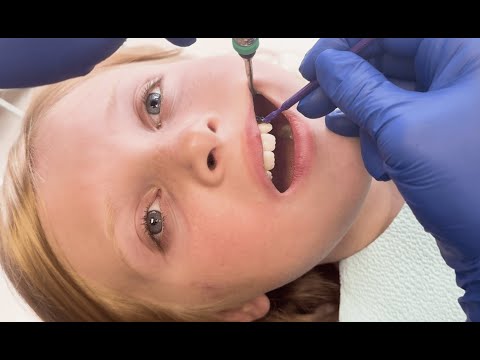 Centrix FluoroDose Sodium Fluoride Varnish Single Dose       - 2