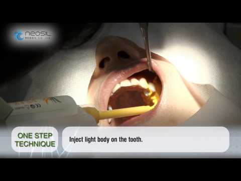 Neosil Peakosil A-Silicone Putty + Light Body Combo Start Kit - 2