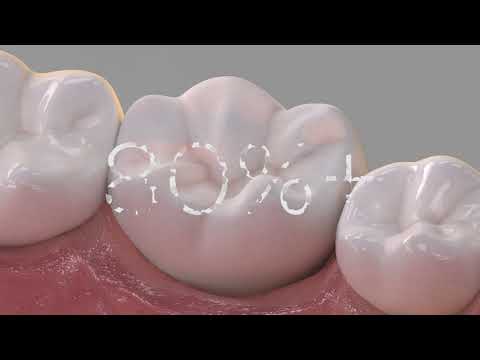 Dentsply Enhance Finishing Systems Kit (624075) - 2