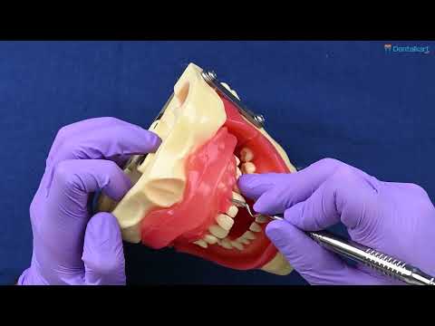 Waldent Periodontal Orban Knife 1/2 (15/769) - 2