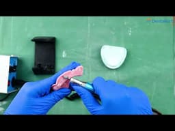 ET Dental Acrylic Polishers Points Mini (Pack of 1) - 2