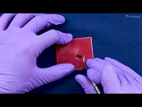 Waldent Periodontal Kirkland Knife 15-16 (15/770) - 2