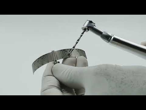 Julldent All on 4 Guide - 2