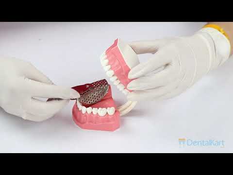 Waldent Adjustable Impression Trays  - 2