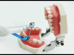 Julldent Mesio Distal Implant Surgical Guide (Dr. Mathai Design) - 2