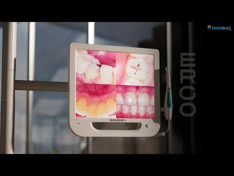 Waldent Intra Oral Camera with Screen - Ergo (10 MP) - 2