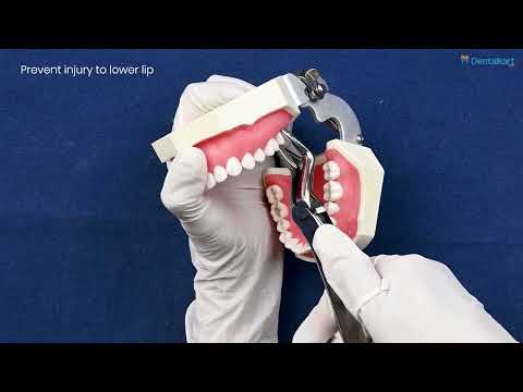 Waldent Tooth Extraction Forceps Upper Roots No.51A (1/106) - 2