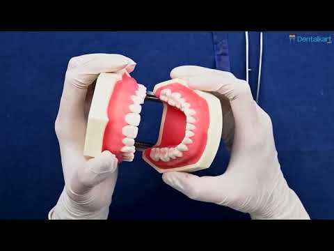 SuperEndo Dental Articulating Paper - 2