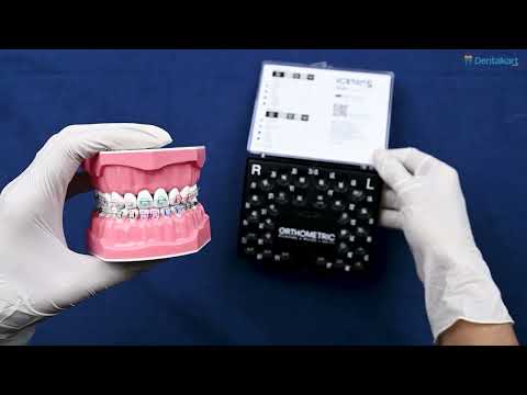 OrthoMetric Iceram-S Monocrystalline Ceramic Bracket MBT 022 - (10.91.2000) - 2