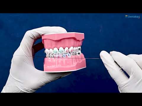 OrthoMetric SS Straight Length Wire (10/Pk) - 2