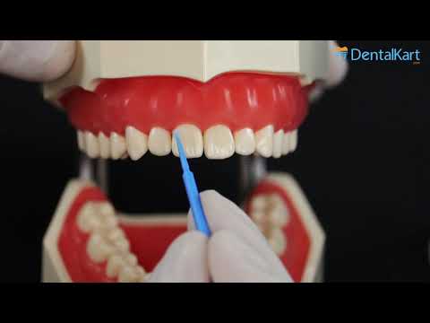 ET Dental Applicator Tips - 2