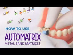 ET Dental Automatrix Metal Bands With Locker - 2