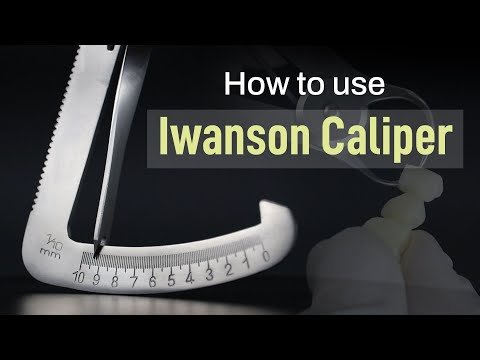 Waldent Iwanson Caliper Metal 0-10mm (60/101) - 2