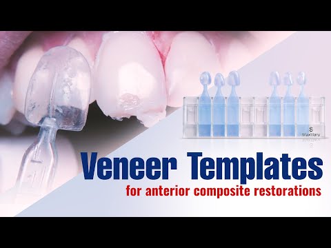 Waldent MyVeneer Composite Template System - 2