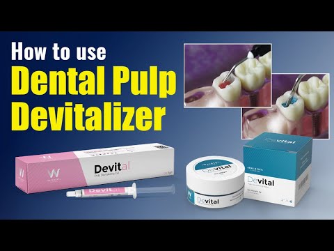 Waldent Devital Pulp Devitalizing Paste  - 2
