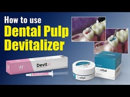 Waldent Devital Pulp Devitalizing Paste  - 2