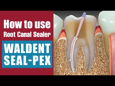 Waldent Seal-Pex - 2