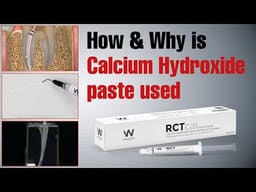 Waldent RCTcal Calcium Hydroxide Paste (Water Based)  - 2