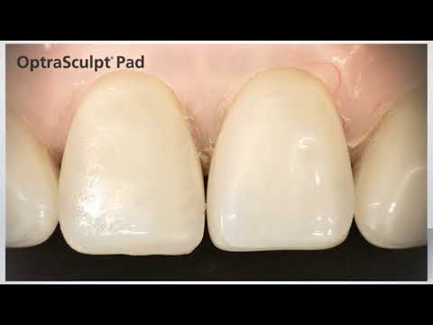 Ivoclar Vivadent OptraSculpt Starter Kit & Refills - 2