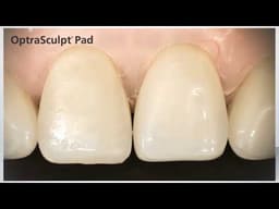 Ivoclar Vivadent OptraSculpt Starter Kit & Refills - 2