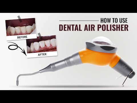 Waldent Premium Air Polisher - 2