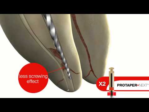 Dentsply Protaper Next Rotary Files Refill - 21mm - 2