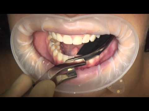 Bausch Arti-Check Dental Articulating Papers Micro Thin - 40µ Microns - 2