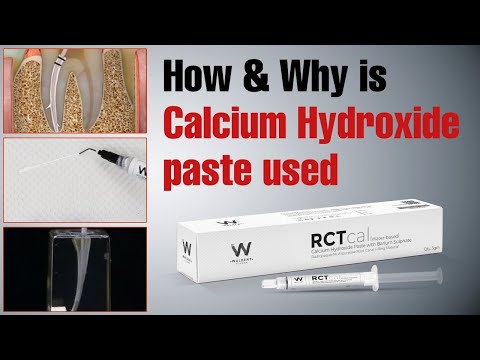 Waldent RCTcal Economy Pack (Pack of 4) - 2