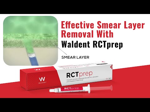 Waldent RCTprep EDTA Economy Pack (Pack of 4) - 2