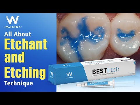 Waldent BESTEtch Economy Pack (Pack of 4) - 2