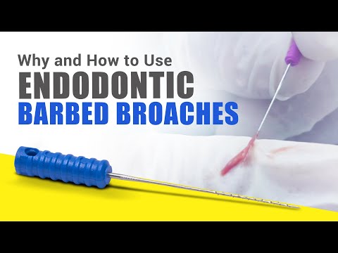 Waldent Barbed Broaches 21mm (Pack of 6) - 2