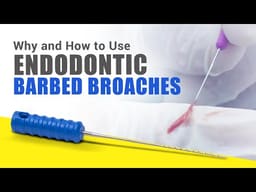 Waldent Barbed Broaches 21mm (Pack of 6) - 2