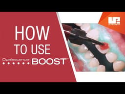 Ultradent Opalescence Boost Pf 40% Plus Mini Kit # 4751-1 - 2