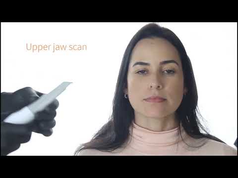 Heron Intraoral Scanner - 2