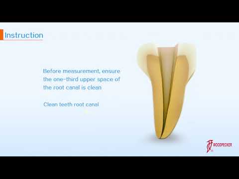 Woodpecker Apex Locator Woodpex III  - 2