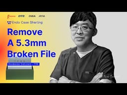 Woodpecker TFRK Terauchi File Removal Kit - 3
