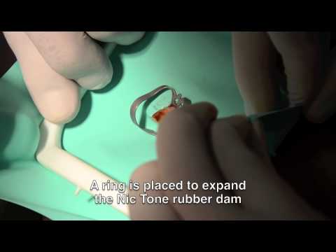 Mdc Antivet Bleaching Agent - 2